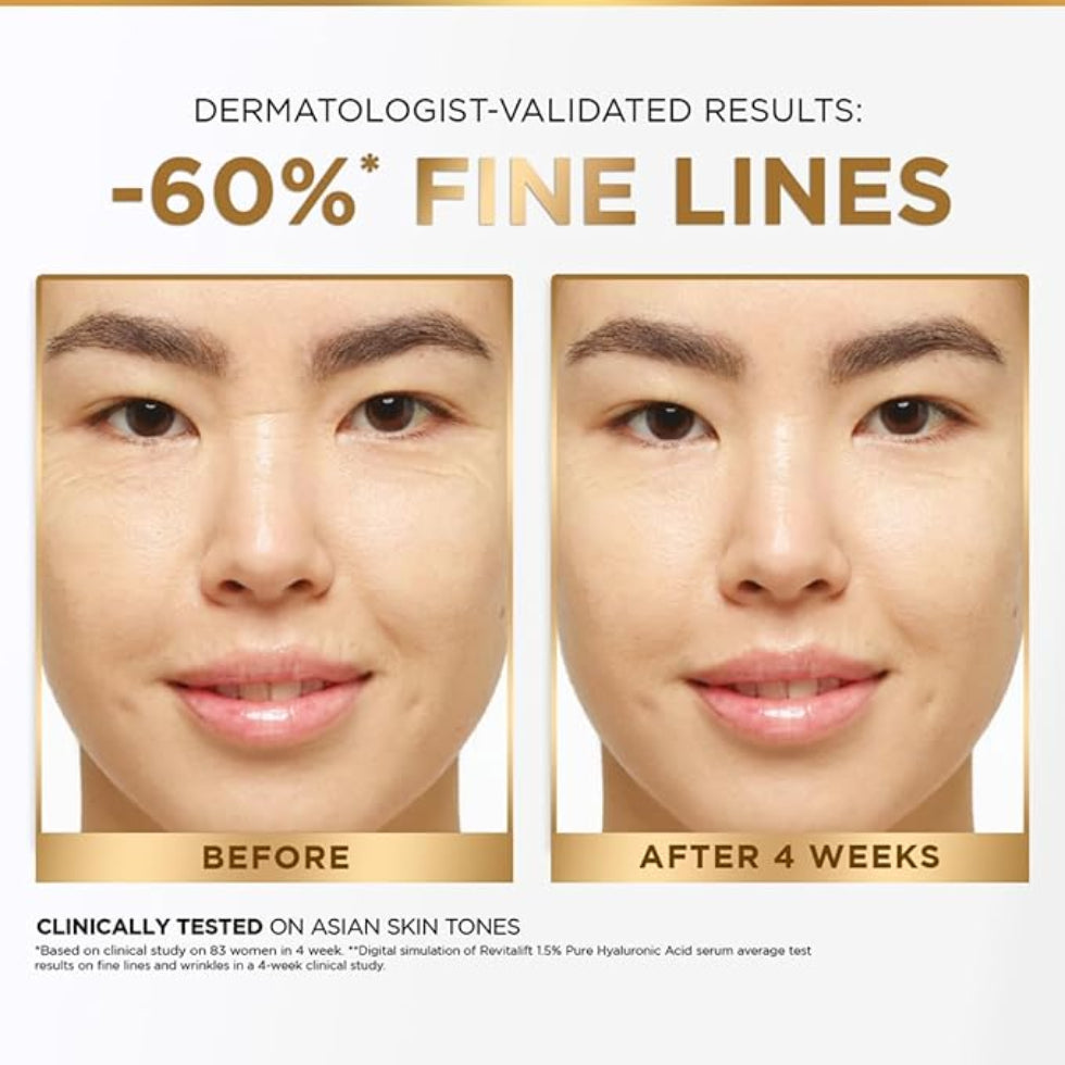 L'Oreal Paris Glycolic Bright 8% [Melasyl + Niacinamide] Face Serum for Brightening Dark Spots